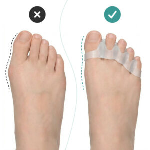 Alternative view of OrthoRelax® – Gelový oddělovač prstů (2 oddělovače)